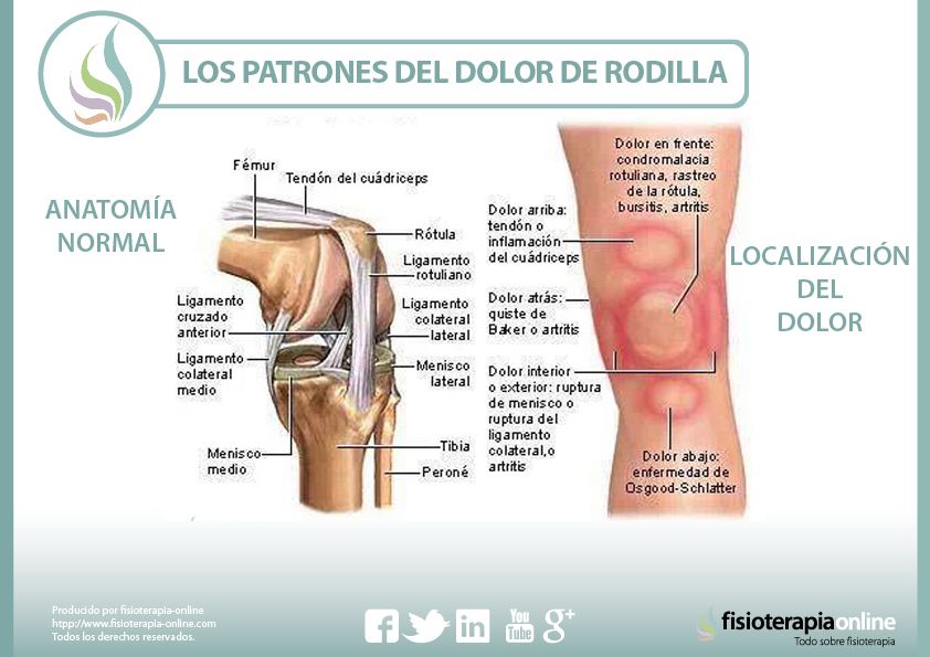 dolor lumbar causas mejores ideas para