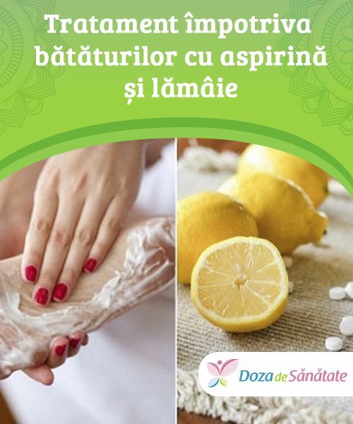 varicoza sistemului bpv varicose farmacie