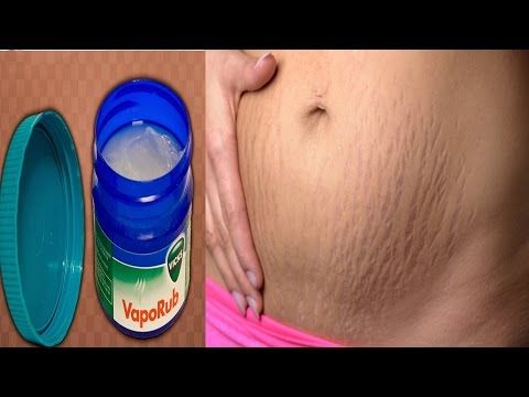 Para que sirve el vick vaporub en las piernas