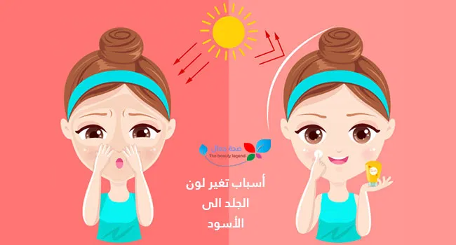 أسباب تغير لون الجلد الى الأسود ماهي الاسباب الرئيسة و ما دلالة كل منها Sehajmal Face Skin Care Clear Skin Tips Sun Protection