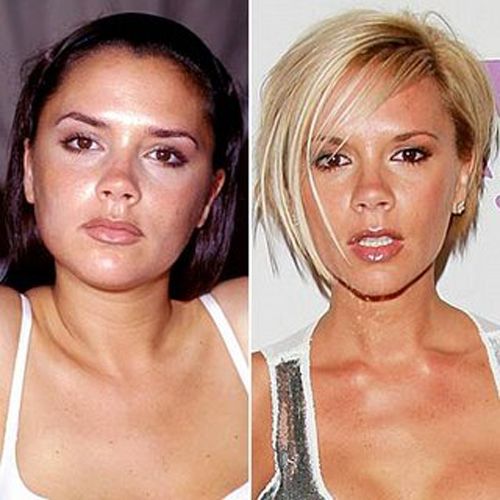 Famosas antes y despues de bajar de peso