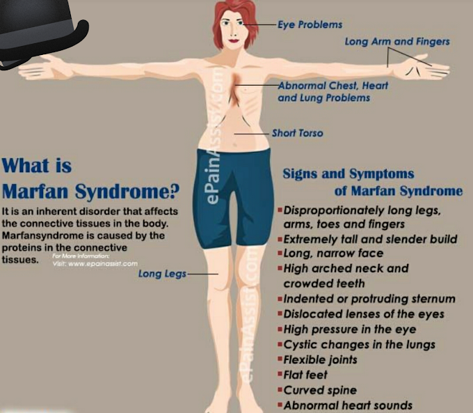 Does Marfan Syndrome Affect The Brain - BRAINLYVI