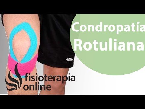 Kinesiotape Para La Condropatia O Condromalacia Rotuliana Condromalacia Rotuliana Condromalacia Tendinitis Rotuliana