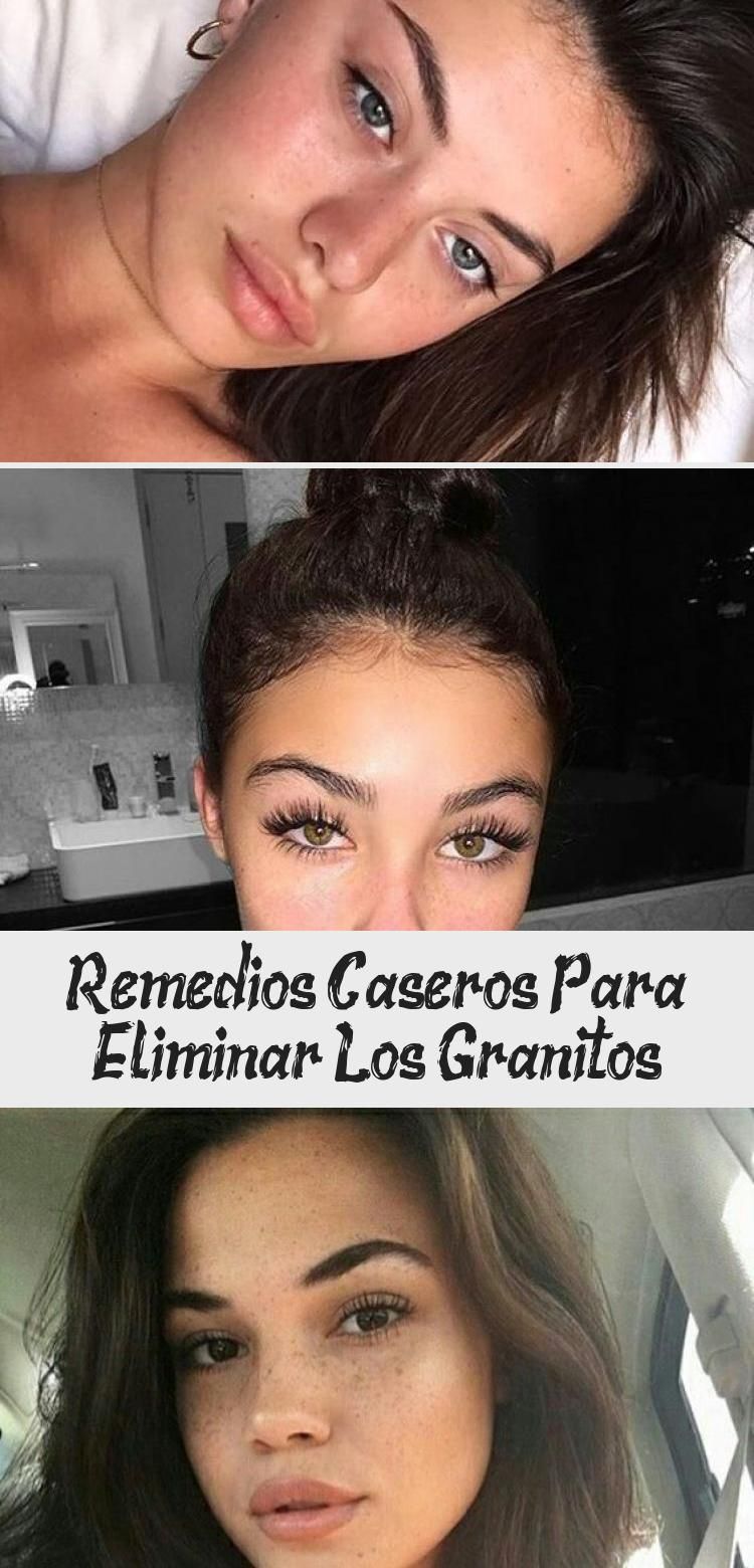 Remedios Caseros Para Eliminar Los Granitos - Makeup | Natural makeup