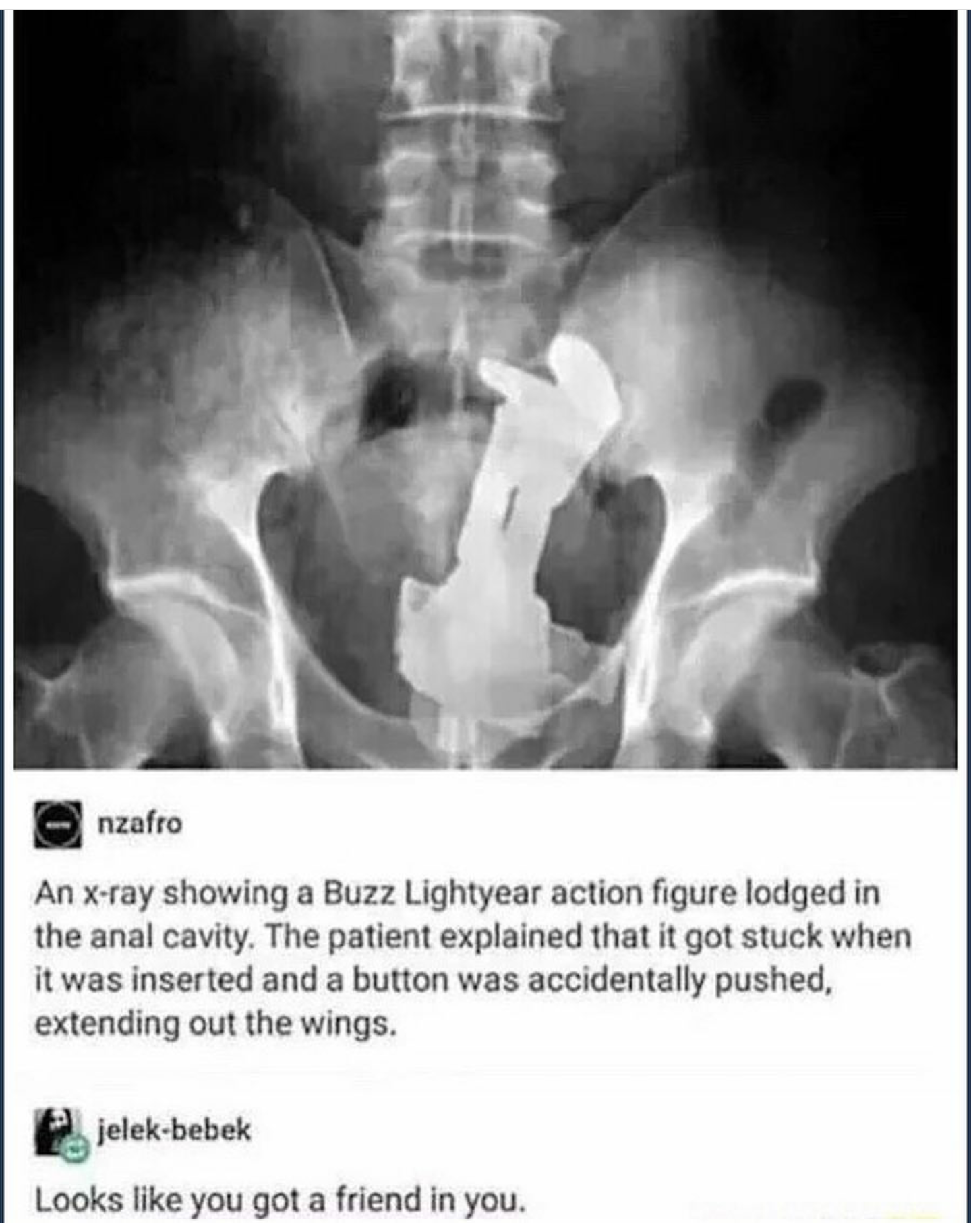 Post A Random Pic Thread Page Yellow Bullet Forums Memes Snapchat Funny Buzz Lightyear Action Figure Post A Random Pic Thread Page Yellow Bullet Forums Memes Snapchat Funny Buzz Lightyear Action Figure