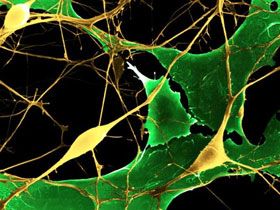 Sinir Sistemi İçindeki Dalgaların Hızının Saniyede 110 Metreyi Bulduğunu Biliyor Musunuz? Omniscient Point Of View, Mystery Meaning, Science Images, Brains Beauty, Cells And Tissues, Scientific Experiment, Animal Cell, Extreme Close Up, Electron Microscope
