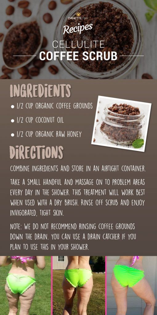 Causes Of Cellulite, Cellulite Remedies, Cellulite Cream, Cellulite Exercises, Reduce Cellulite, Anti Cellulite, Cellulite Workout, Thigh Cellulite, Coffee Cellulite Scrub