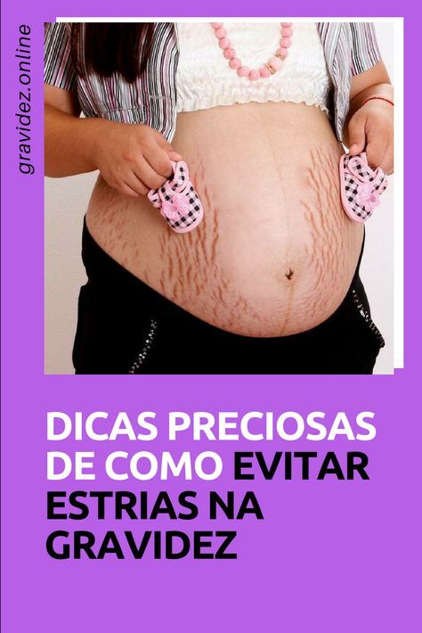 CUIDADOS com a barriga para EVITAR ESTRIAS