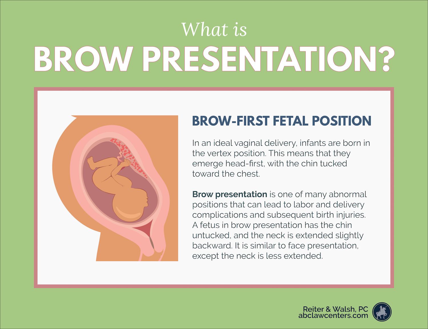 what is meaning of brow presentation