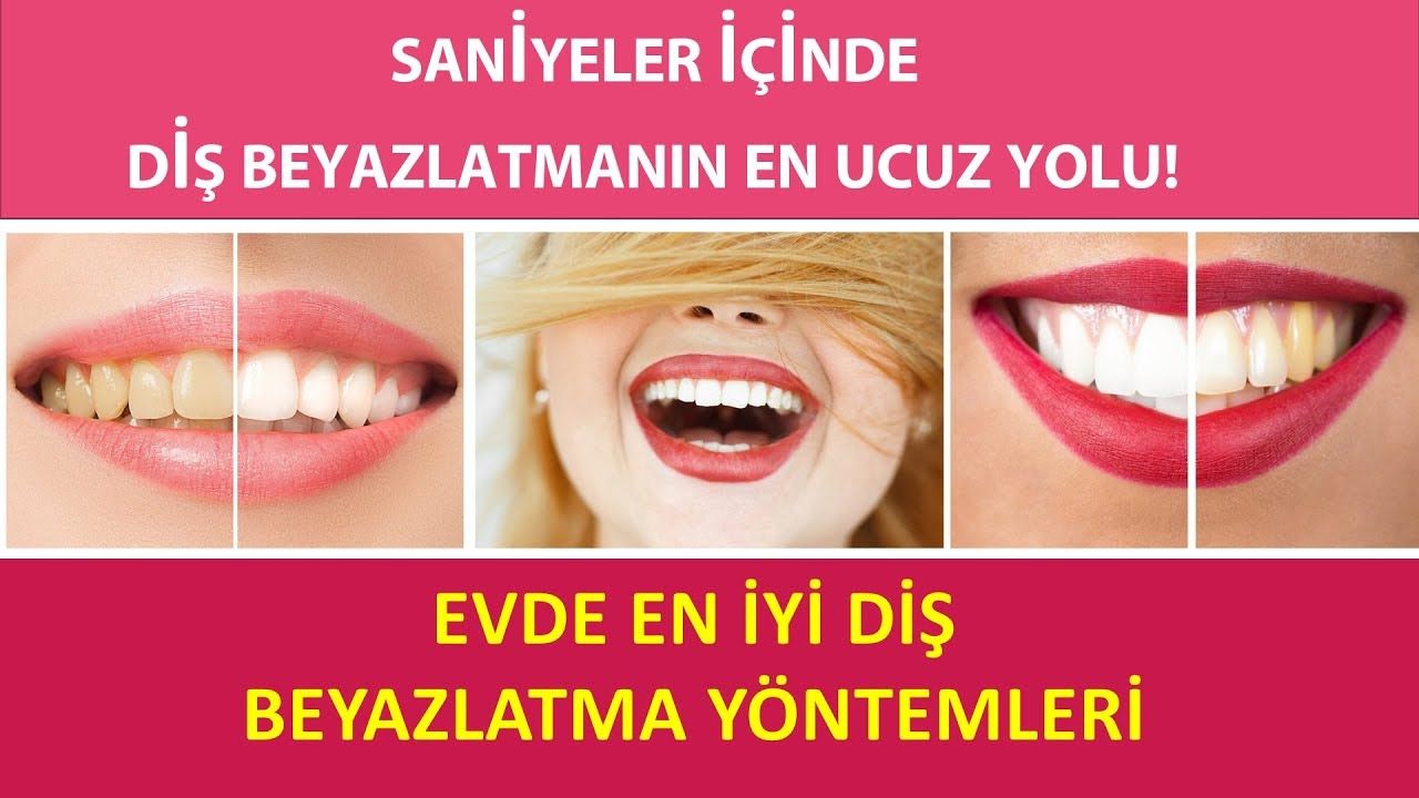 Evde Diş Beyazlatmanın 8 Yolu Evde Diş Beyazlatmanın 8 Yolu