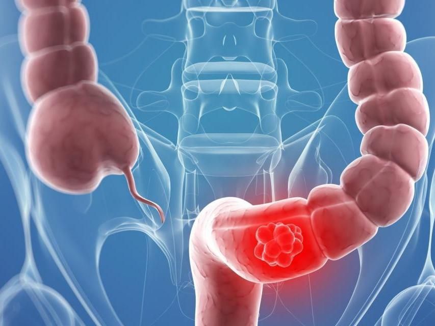 نصائح لمرضى القولون العصبي صحيفة مكة انفوجرافيك صحة Health Fitness Nutrition Health Fitness Health