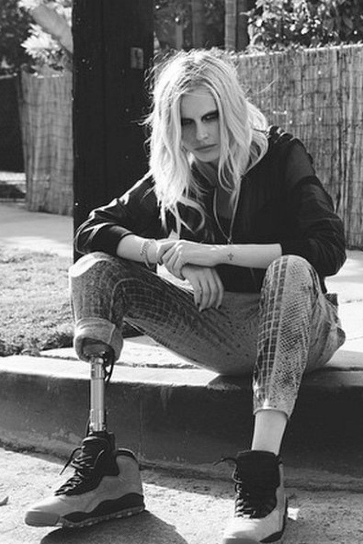 Model Who Lost Leg To Toxic Shock Syndrome Lands Huge New Campaign