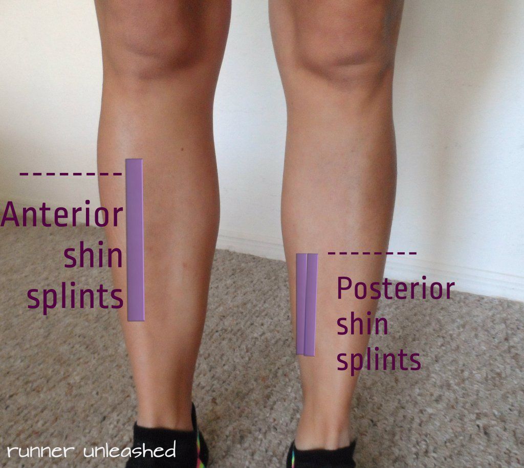 Do NOT want to this one!! > How to treat Shin