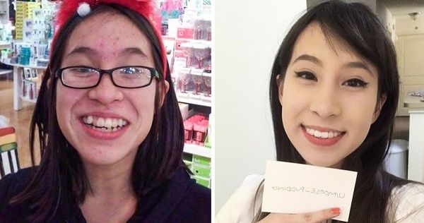 15 Chicas que no les gustaba como se veían en su adolescencia, pero que pudieron transformarse a un punto que son casi irreconocibles Facial Exercises, Twitter Trending, Unattractive, Female Soldier, Girl With Curves, Nerve Pain, Change, Survival Skills, Survival Tips