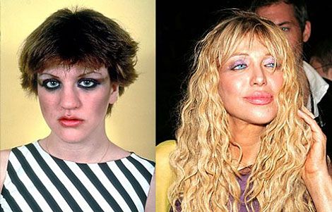free courtney love plastic surgery