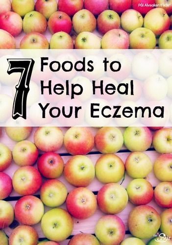 7 foods to help heal eczema from the inside out cafemom s top pins huh who would have thought no 5 seven foods to help heal eczema from the inside out http thestir cafemom com food party 169070 7 foods to help heal