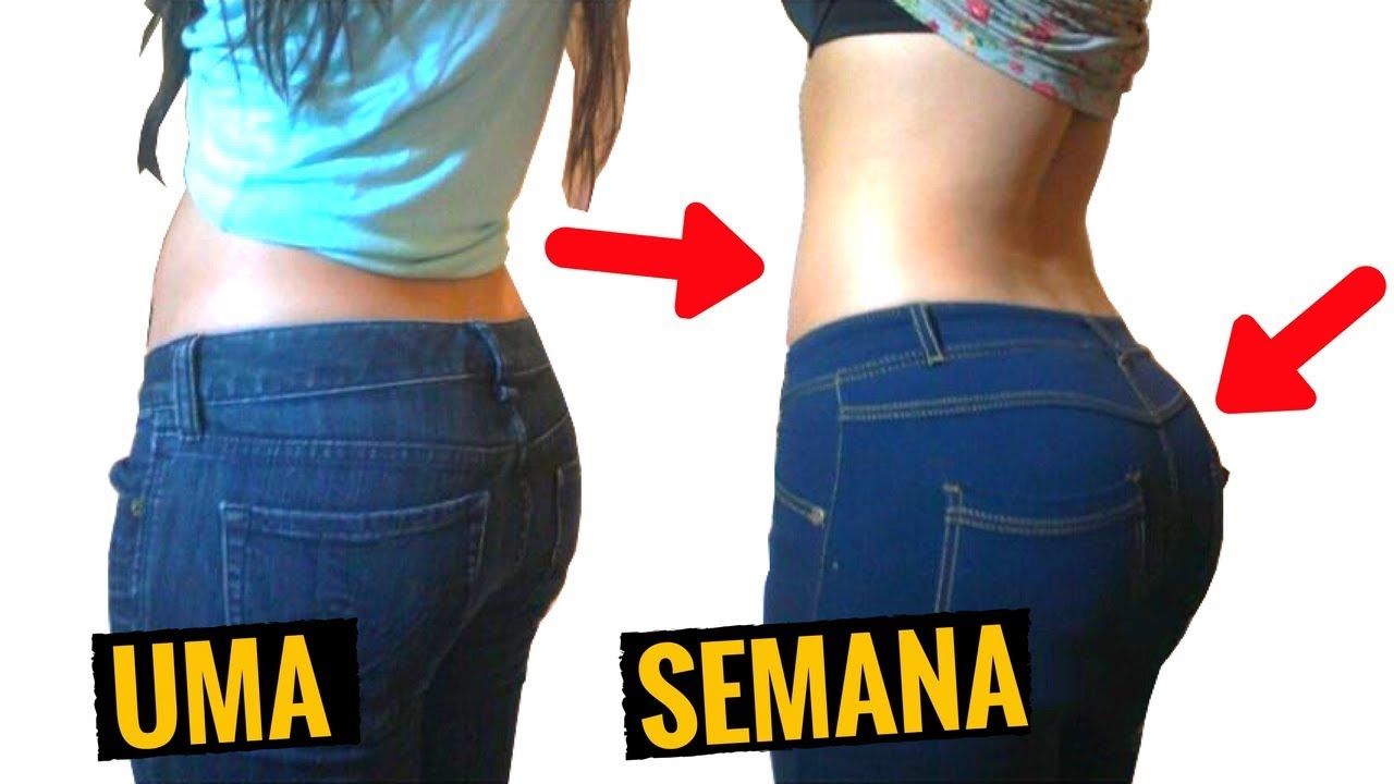 Preenchimento De Glúteo Antes E Depois Pin em ?? SAÚDE - VIVA MELHOR!