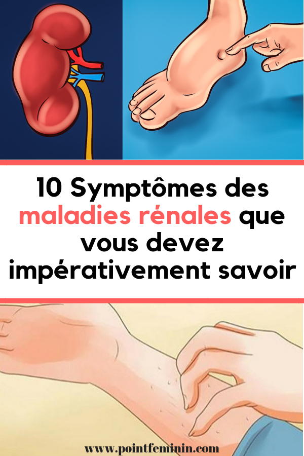 10 Symptômes Des Maladies Rénales Que Vous Devez Impérativement Savoir 