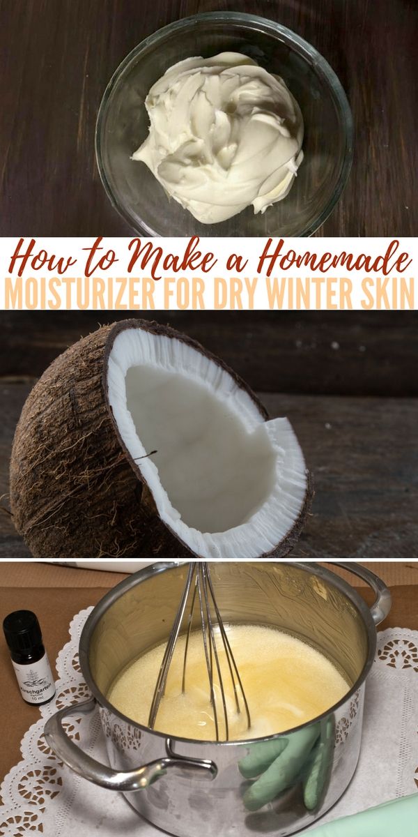 How to Make a Homemade Moisturizer for Dry Winter Skin