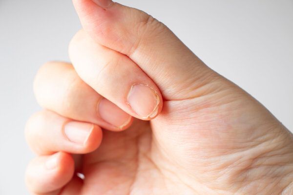 家にあるもので爪割れの補修を行う方法｜必要な物3選