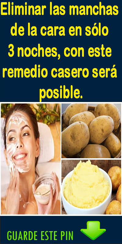 Pin On Remedios Caseros