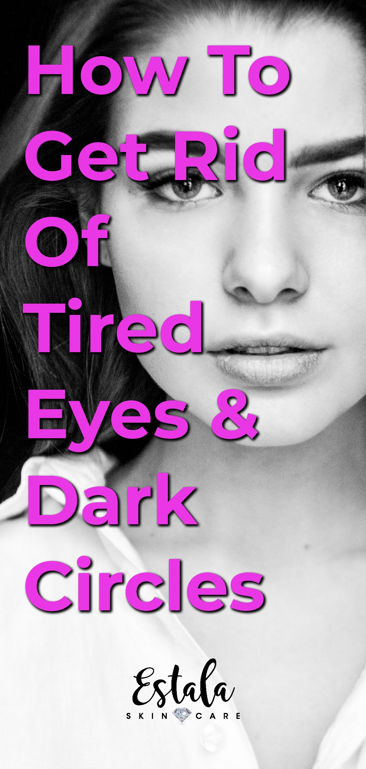 download sudden dark circles under eyes download sudden dark circles under eyes