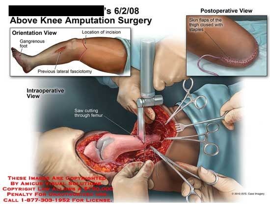 Pin By Kate Himes On Therapy Knee Exercises Yoga Relief Wheelchair Exercises
