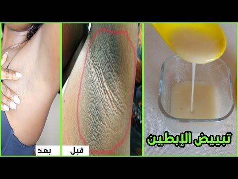 تبيض الابط و علاج سواد الابط من اول استعمال وقسما بالله مجربة وصفة سحرية Youtube Makeup Skin Care Skin Care Skin Makeup