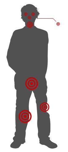 Memorize some basic pressure points. | 12 Self-Defense Tips That Could Come In Handy One Day Techniques D'autodéfense, Self Defense Techniques, Survival Techniques, Survival Prepping, Emergency Preparedness, Survival Skills, Emergency Kits, Survival Equipment, Survival Food