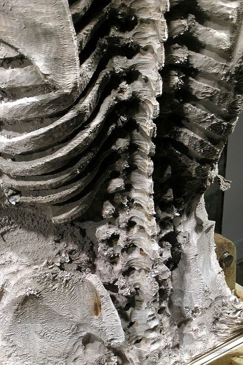Maskull Lasserre Lexicon Detail City Of Ottawa Human Spine Canadian Artists Medical Art