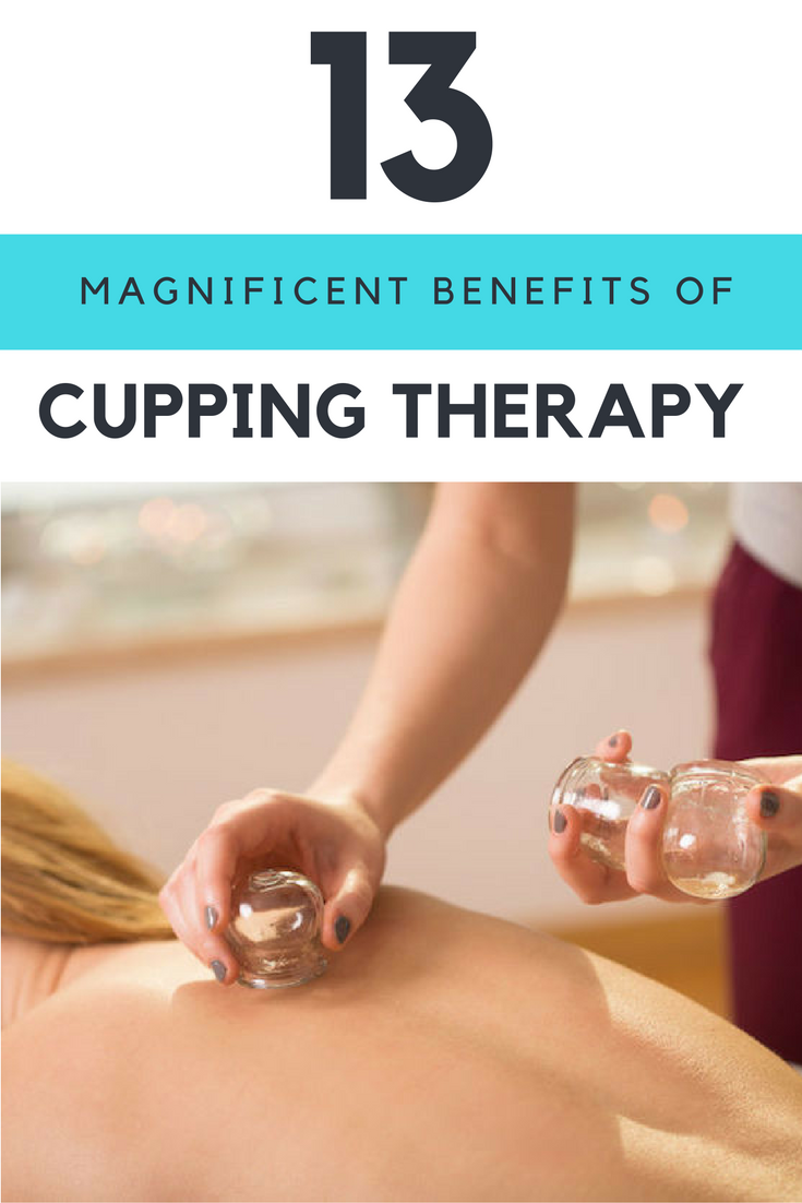 Is Cupping the Holy Grail of Recovery Maybe—or Maybe Not, Researchers Say Is Cupping the Holy Grail of Recovery Maybe—or Maybe Not, Researchers Say new photo Is Cupping the Holy Grail of Recovery Maybe—or Maybe Not, Researchers Say Is Cupping the Holy Grail of Recovery Maybe—or Maybe Not, Researchers Say new photo