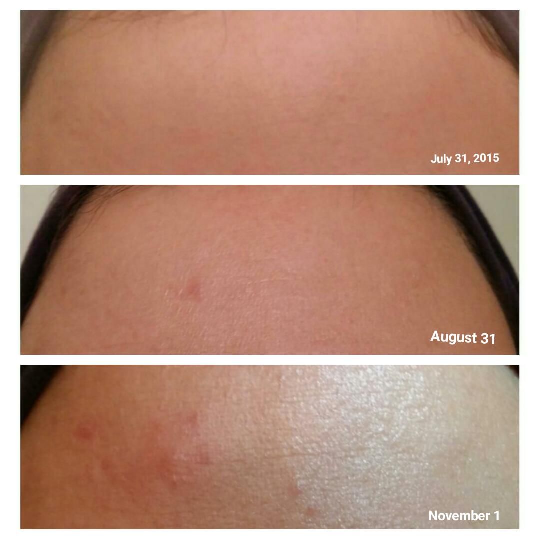 medik8 c tetra serum medik8 c tetra serum