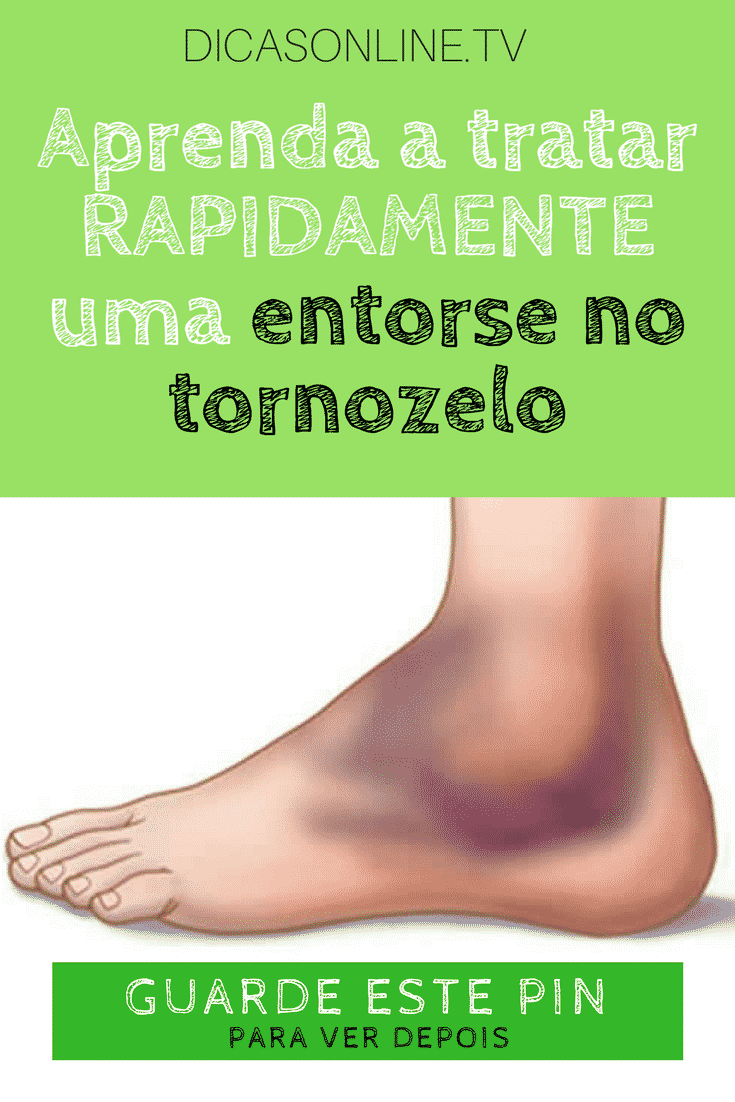O inchaço tratar da entorse tornozelo como de