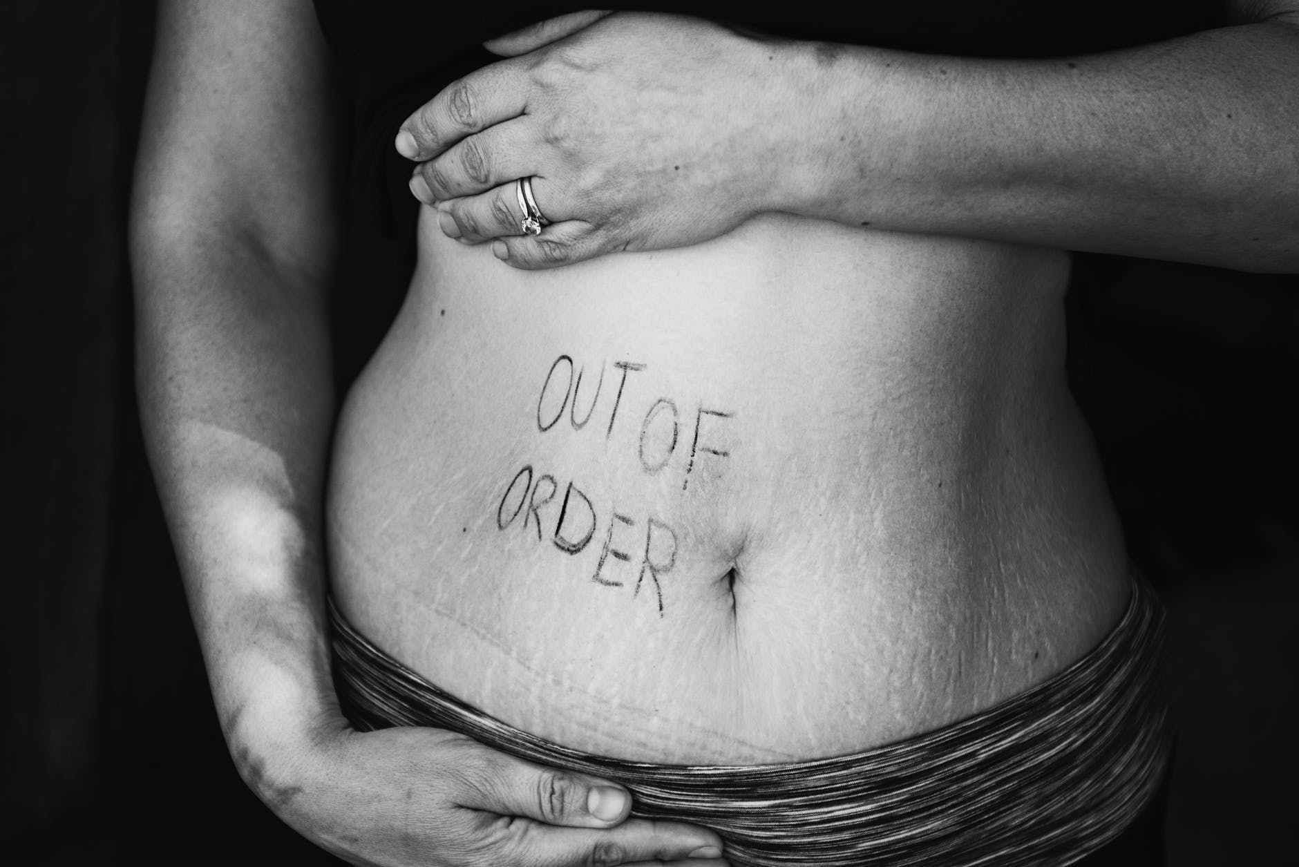 Pelvic Floor Incontinence The Differences Causes And Treatments