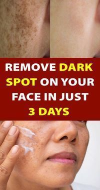 Find Out Who is Worried About Remove Brown Spots a Find Out Who is Worried About Remove Brown Spots a