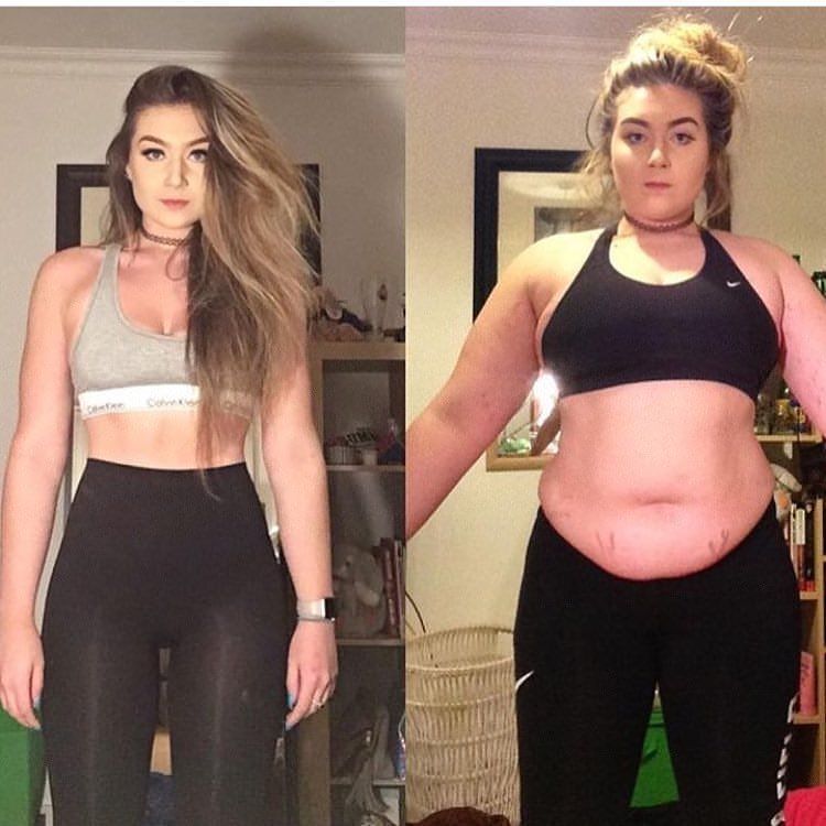 Seems Before and after weight loss inspiration are absolutely With you Before and after weight loss inspiration confirm. agree