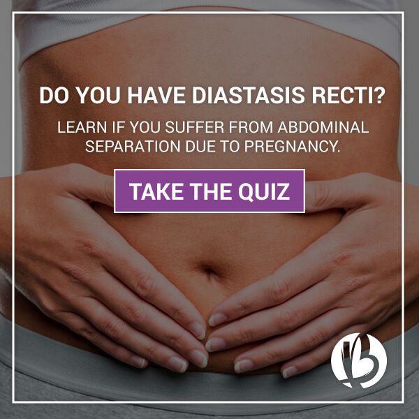 How To Fix Diastasis Recti Years Later Australia