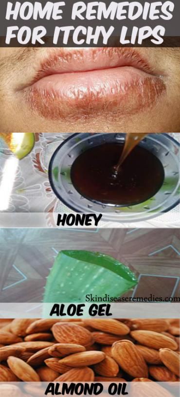 7 land house Remedies for Itchy Lips | Cure for chapped lips