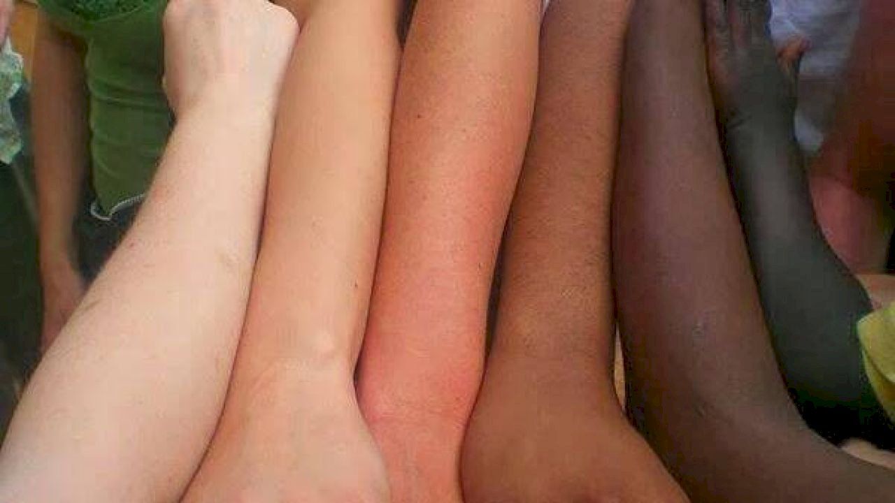 تغير لون الجلد Color Change Color Skin Color