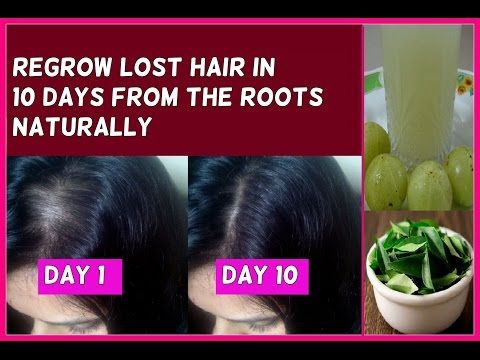 The 3 Best Laser Caps Hair Growth Helmets In 2020 Laser Hair