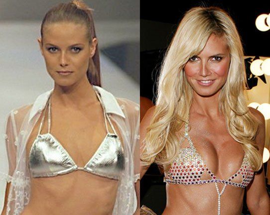 surgery huge natural boob Surgery huge natural boob