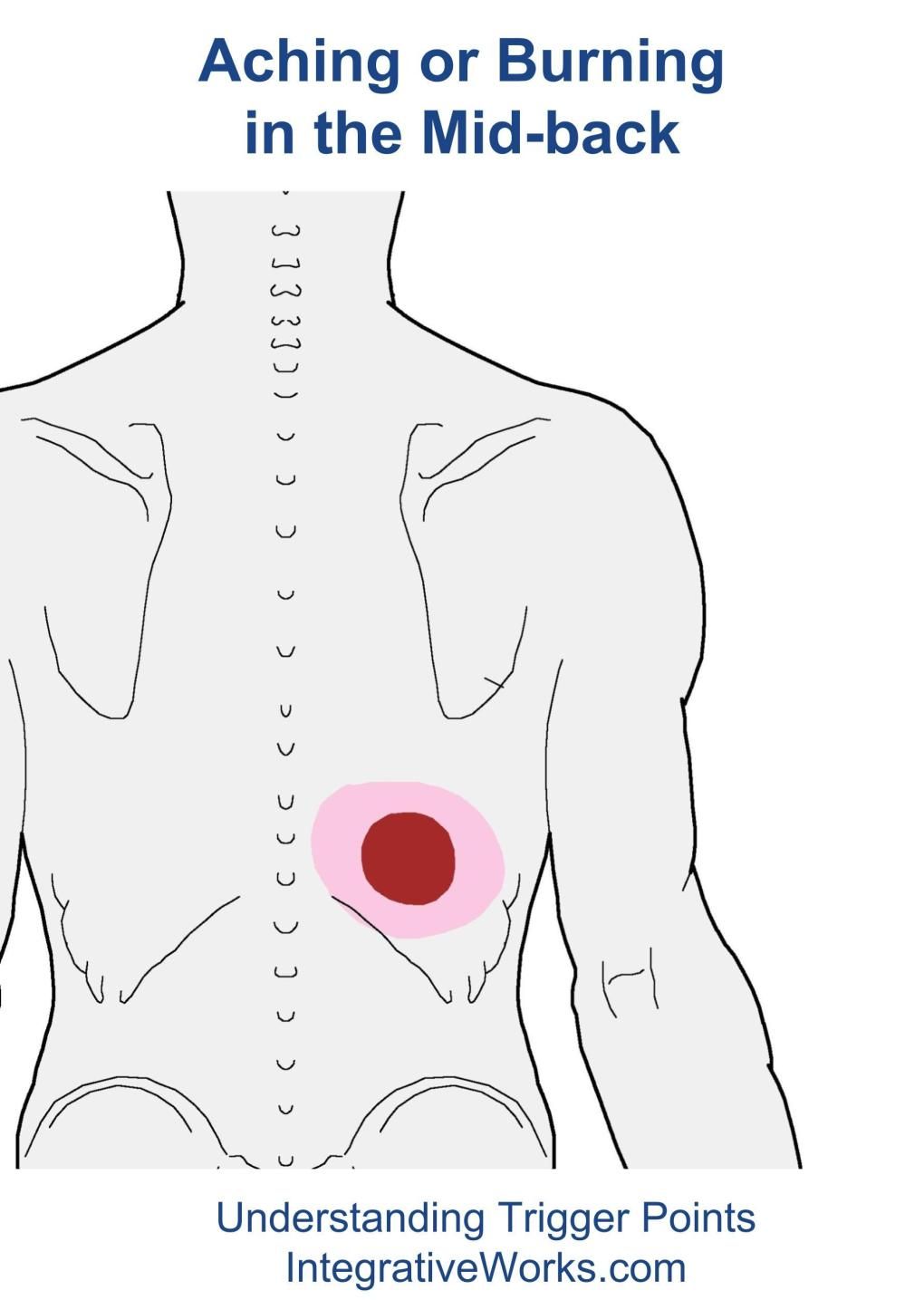 Trigger Points Aching And Burning In The Mid BackIntegrative Works trigger-points-aching-and-burning-in-the-mid-backintegrative-works