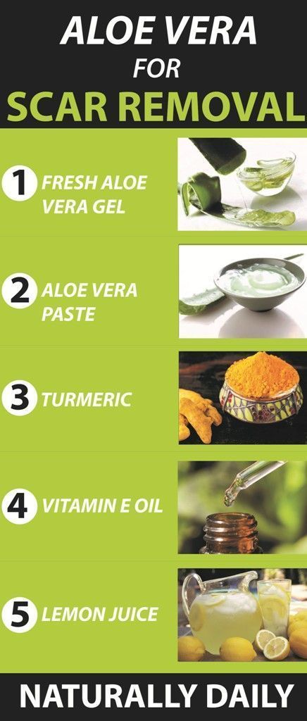 Aloe Vera for Scars RemovalReduce Acne ScarsBurn Scars Naturally aloevera scars homeremedies RemoveAcneScars Acne Treatment Overnight, Back Acne Treatment, Acne Treatments, Beauty Treatments, Gel Aloe, Aloe Vera Gel, Aloe Vera For Scars, Fresh Aloe Vera, Aloe Vera Face Mask