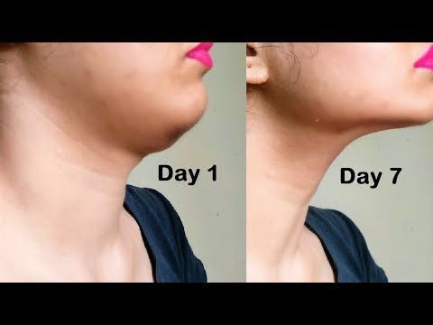 easy ways to lose weight in face