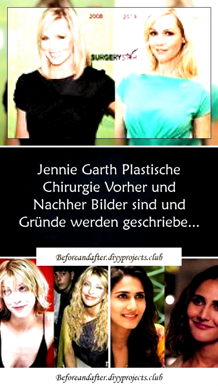 #bilder #chirurgie #garth #jennie #nachher #plastische #vorher #Love #plastic <br />Courtney“></p>
<p><a class=