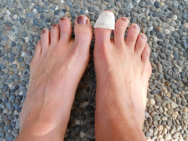 bacterial nail infection nails care nails art pinterest toe
