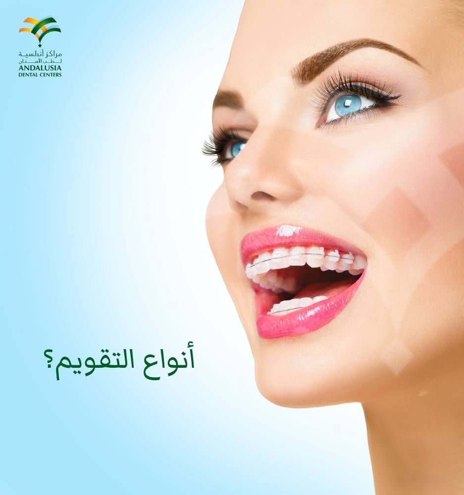 أهم 3 انواع تقويم الأسنان وما هي مميزات وعيوب تقويم الأسنان Dental Center Dental Andalusia