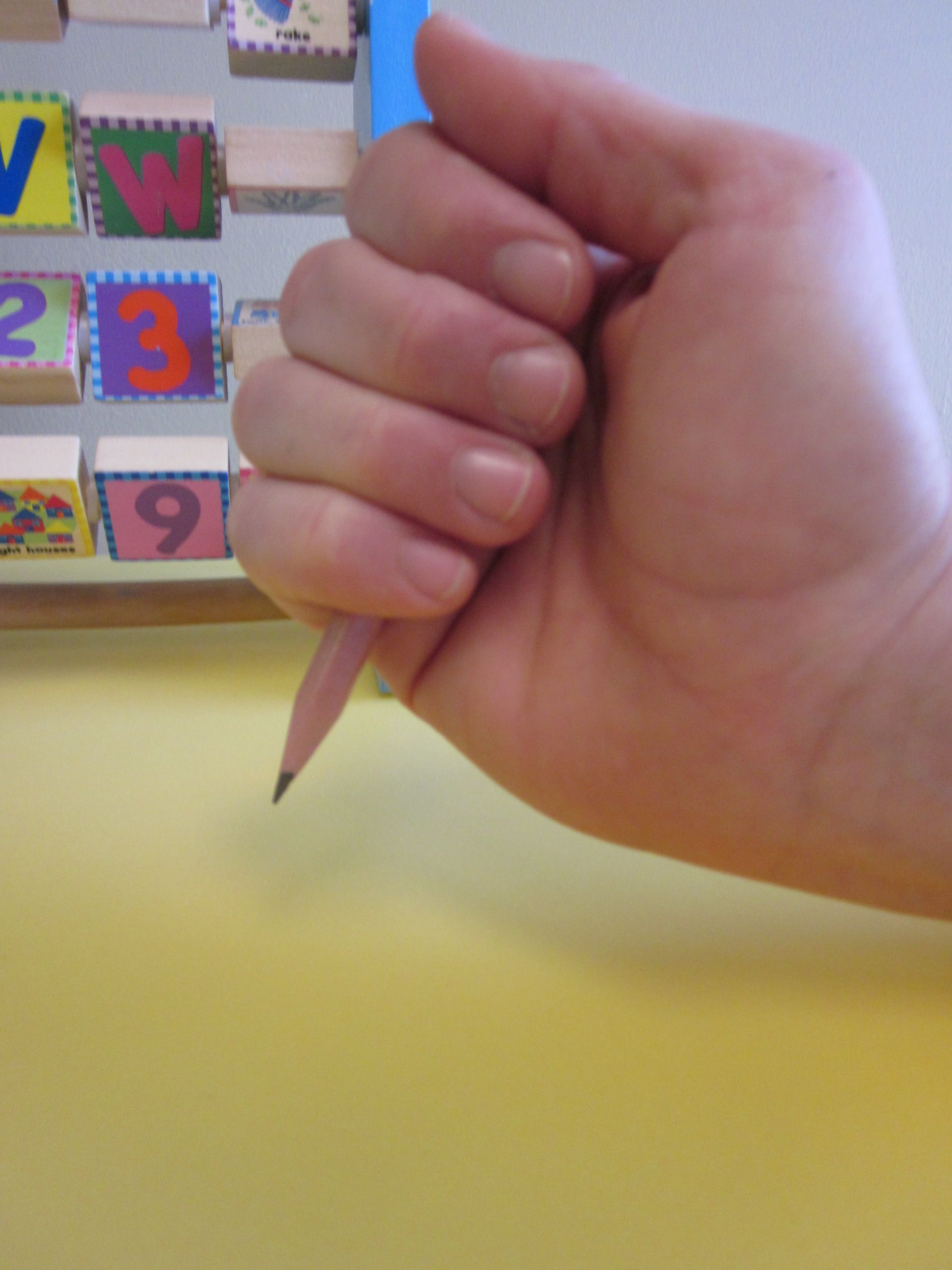 Single palmar crease aspergers