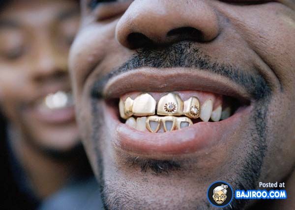 Meme Alert Gold 3 000 Grillz Teeth Grillz Gold Teeth