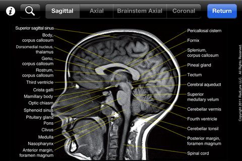 diagram iphone 5 brain, Corpus 35 images Awesome Mri brain Brain, labeled diagram iphone 5 brain, Corpus 35 images Awesome Mri brain Brain, labeled
